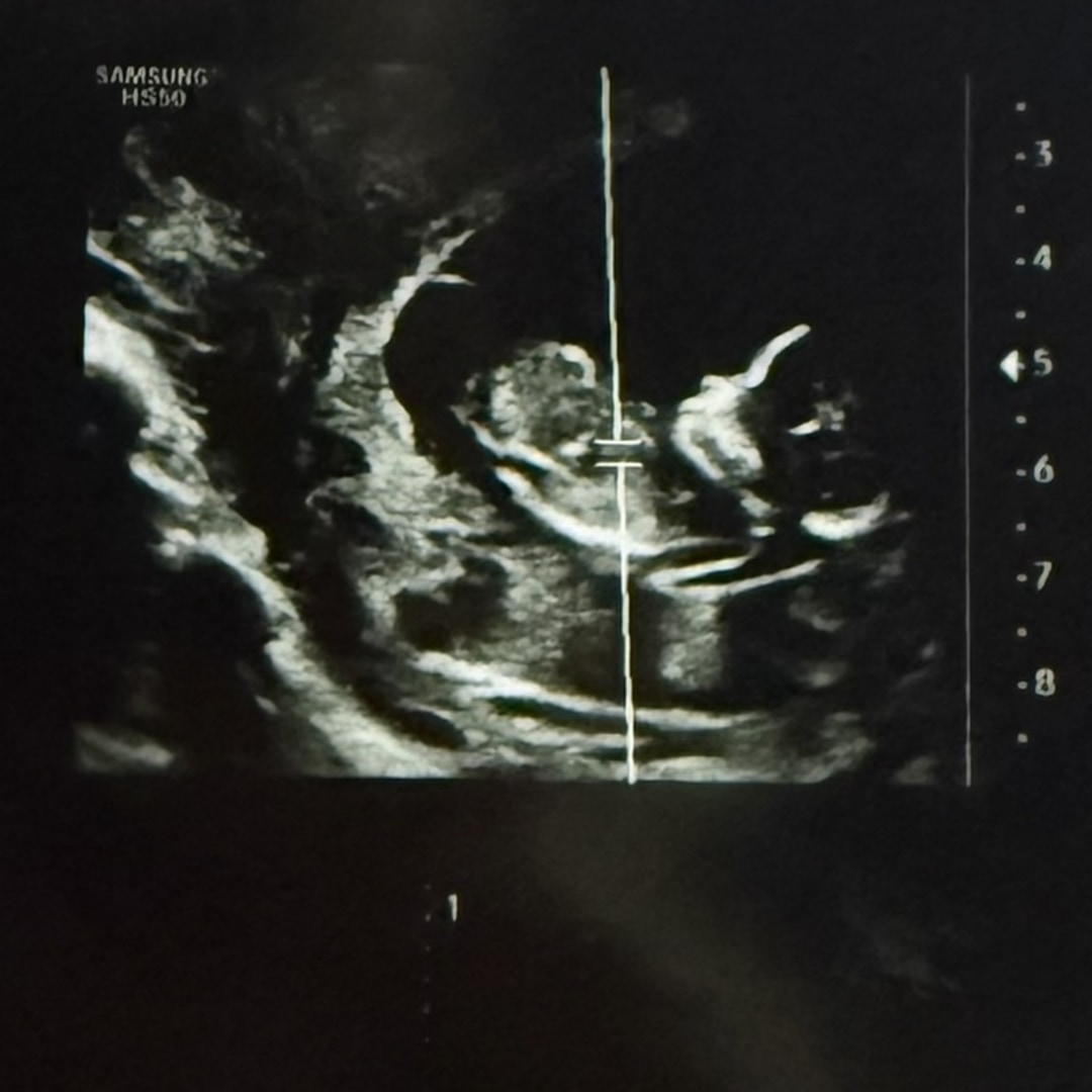 Photo shared by Hayley for their Babylist baby registry.