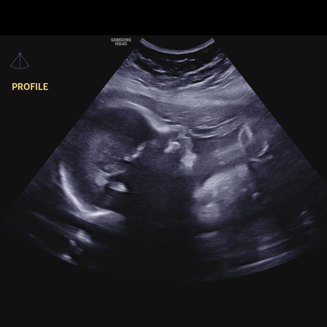 Photo shared by Katelyn for their Babylist baby registry.
