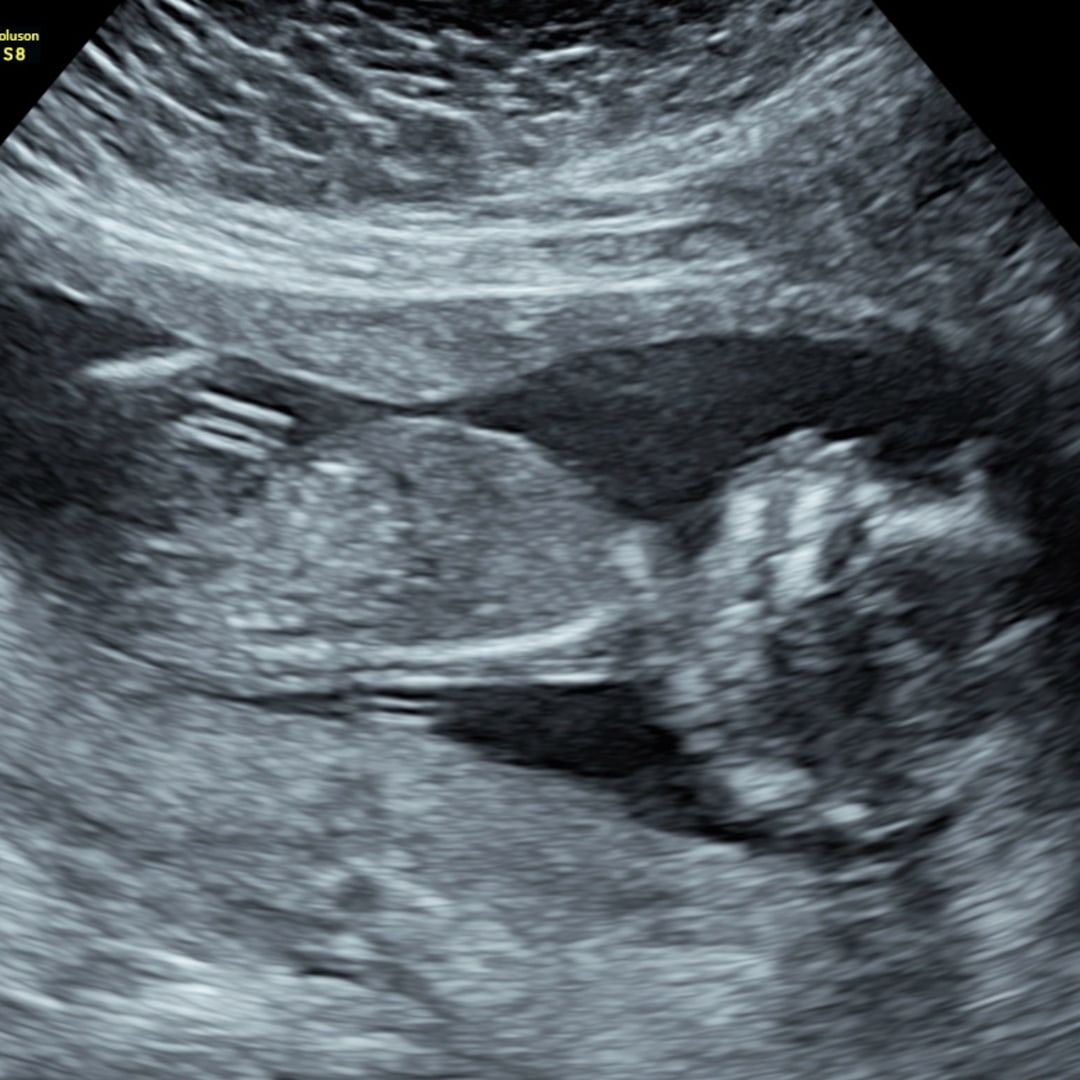 Photo shared by Jenny for their Babylist baby registry.