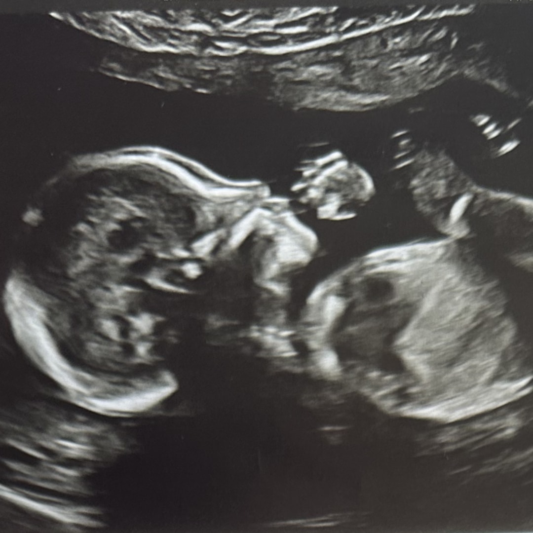 Photo shared by Alejandra for their Babylist baby registry.