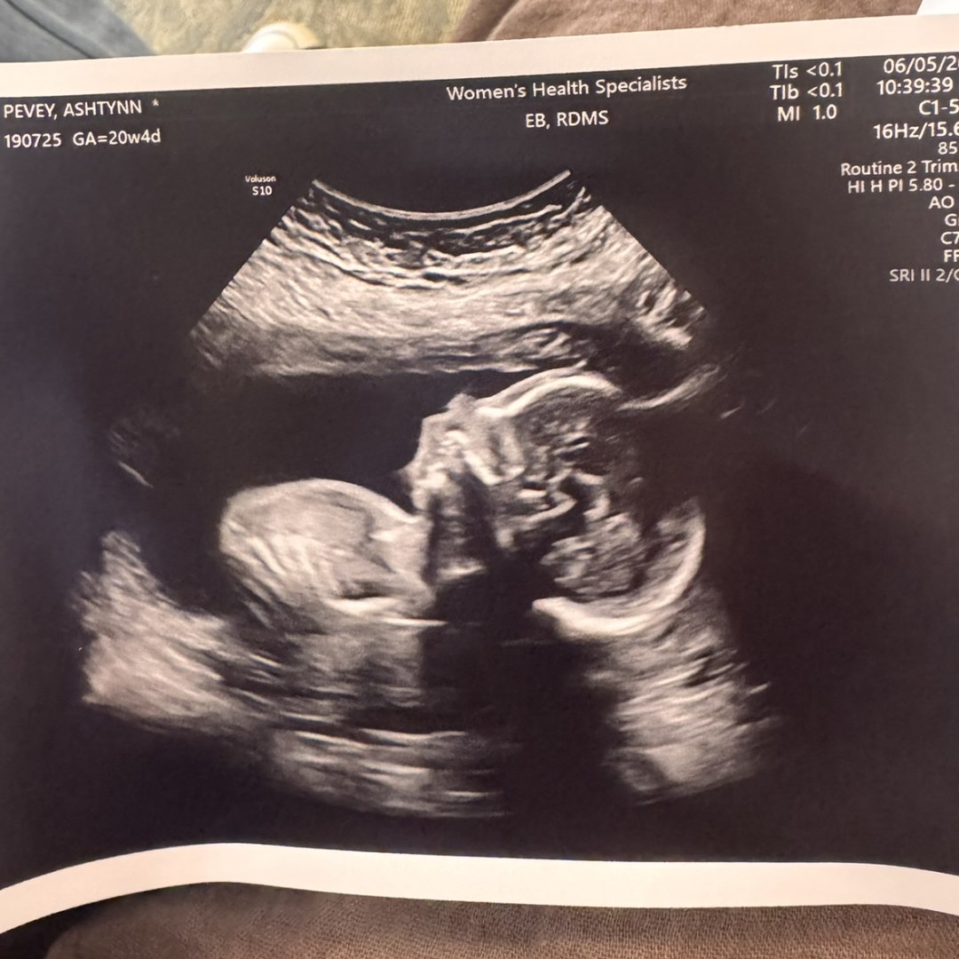 Photo shared by Ashtynn for their Babylist baby registry.