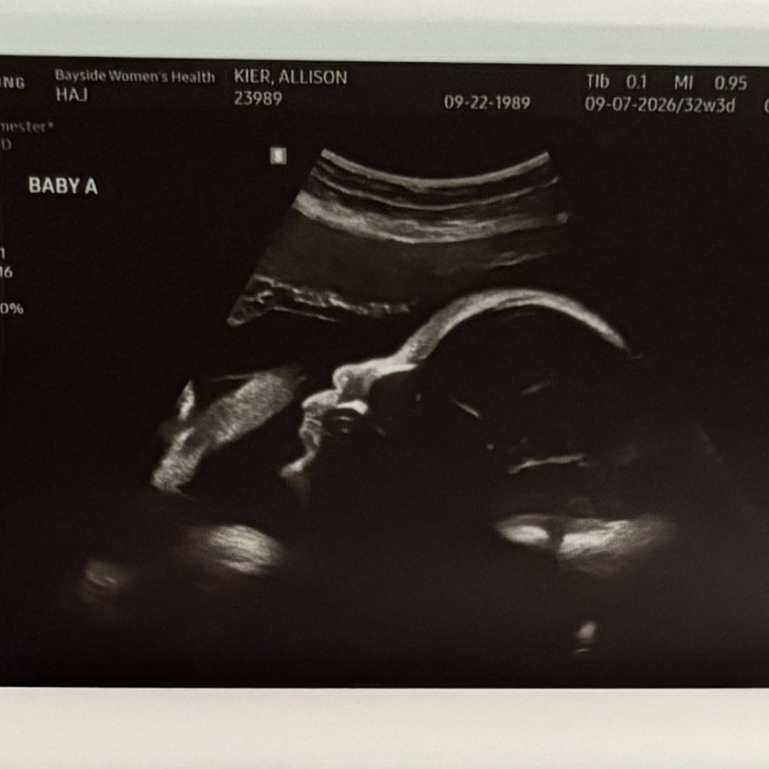Photo shared by Allison for their Babylist baby registry.