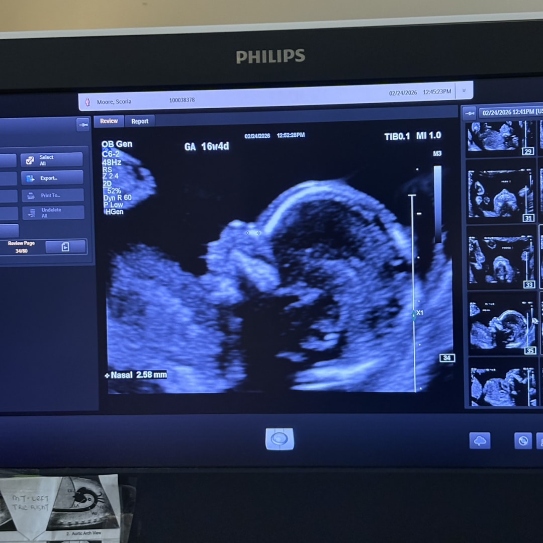 Photo shared by S’coria for their Babylist baby registry.