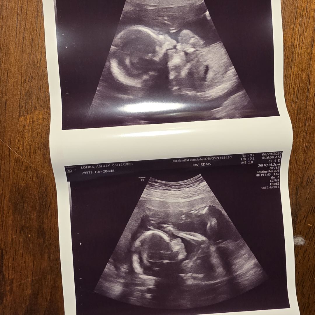 Photo shared by Ashley for their Babylist baby registry.
