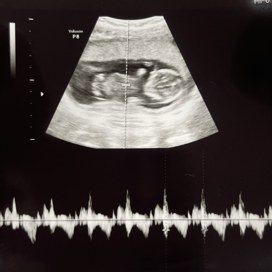 Photo shared by Cristina for their Babylist baby registry.