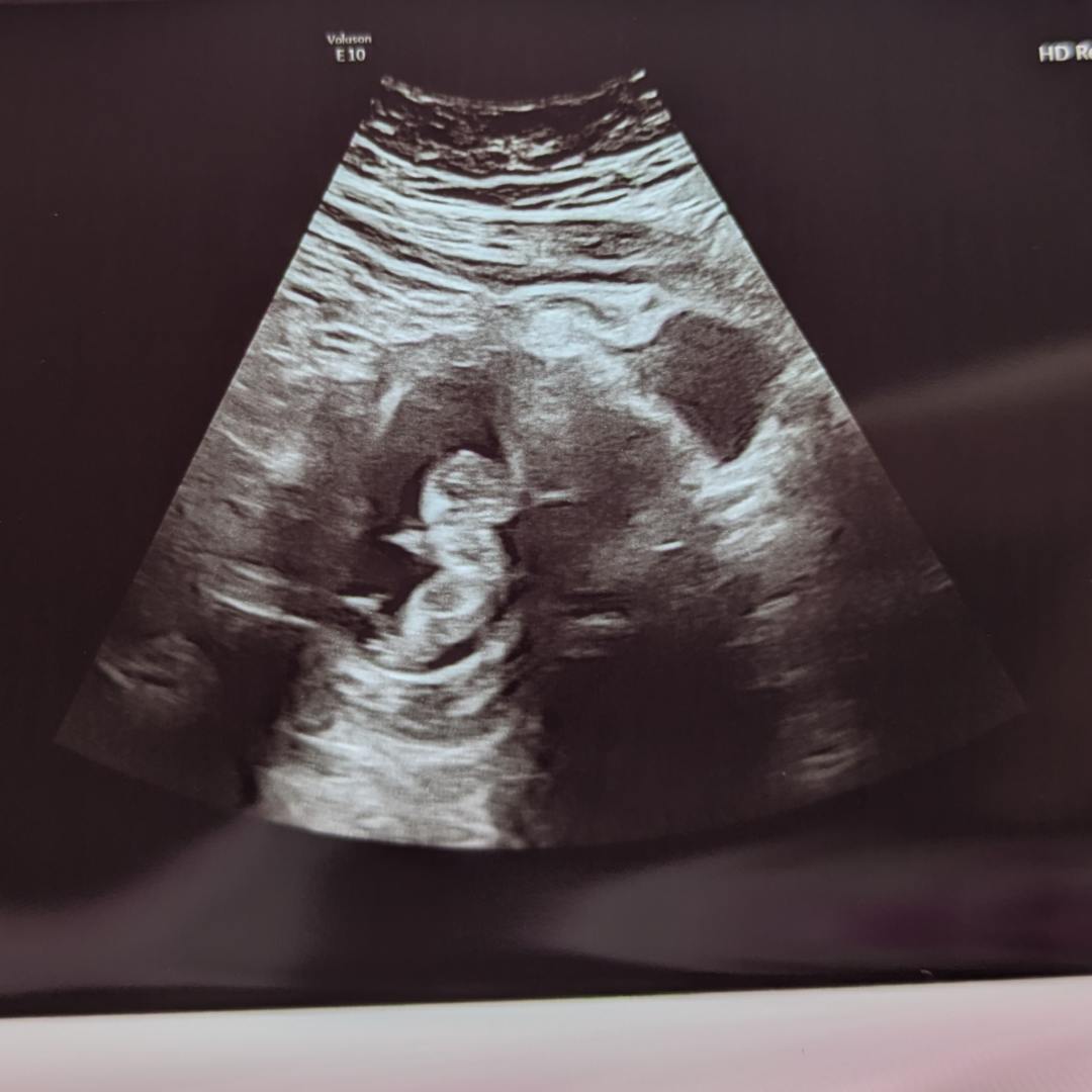 Photo shared by Elizabeth for their Babylist baby registry.