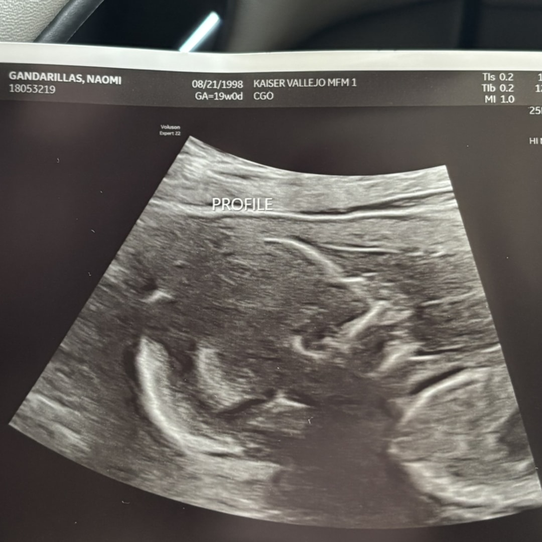 Photo shared by Naomi for their Babylist baby registry.