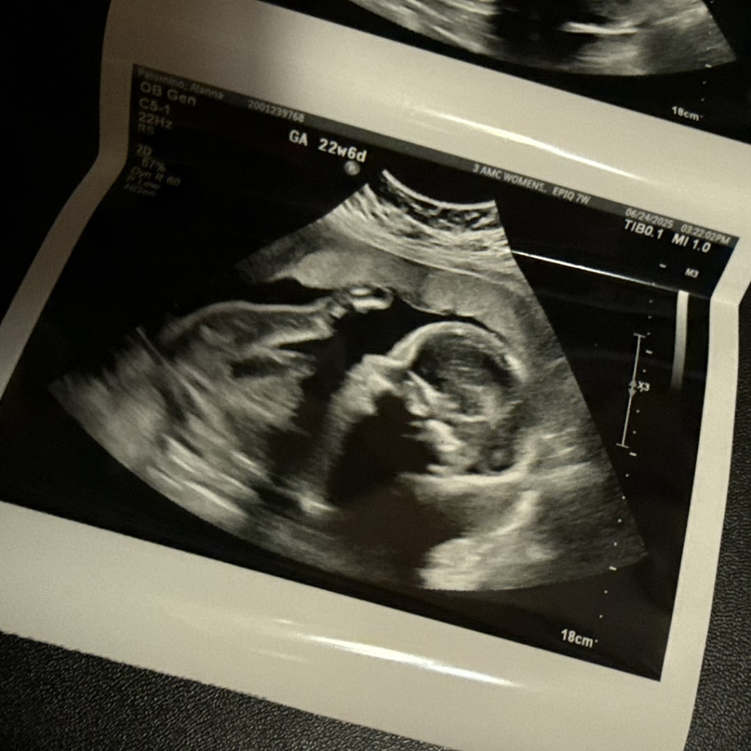 Photo shared by Alanna for their Babylist baby registry.