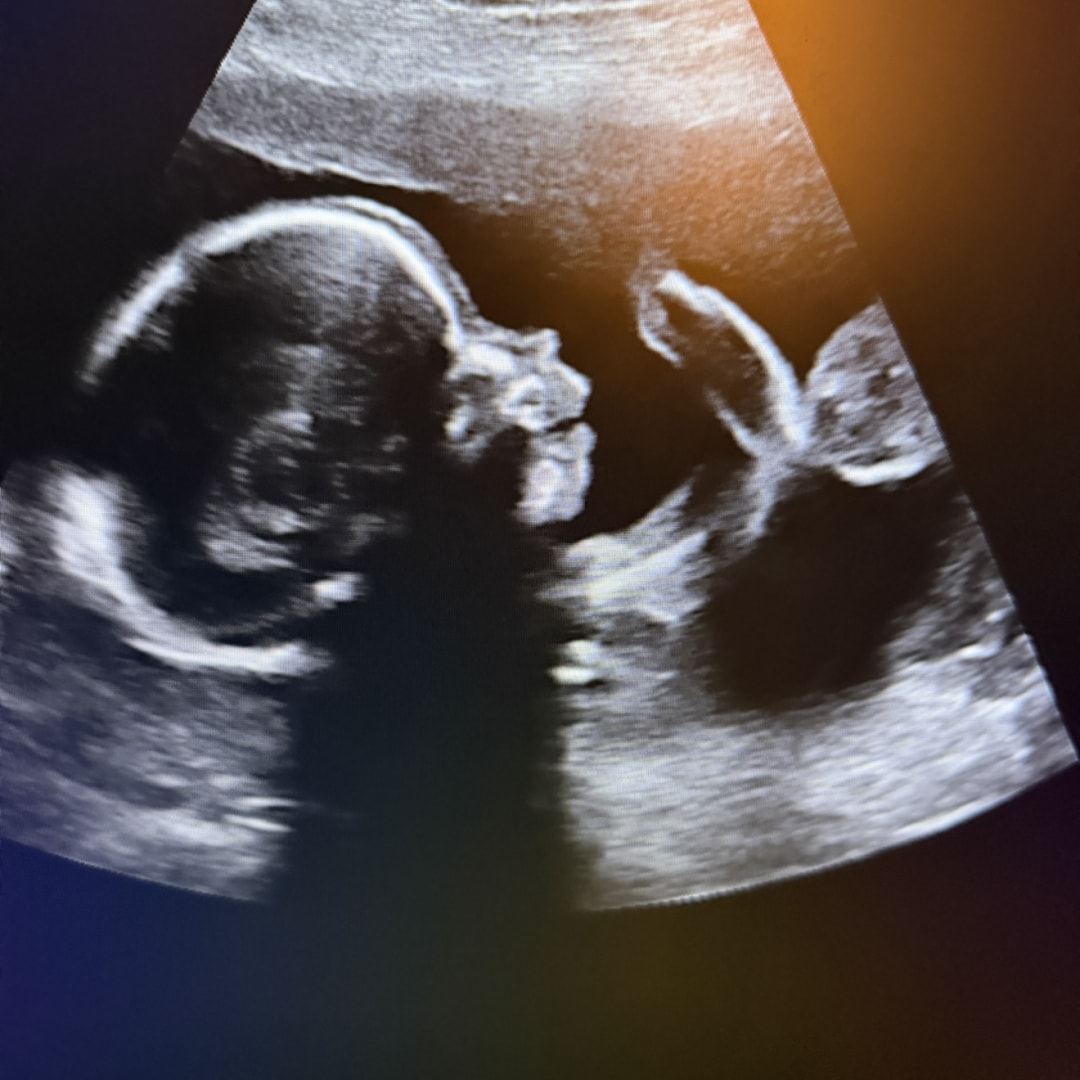Photo shared by Mackenzie for their Babylist baby registry.
