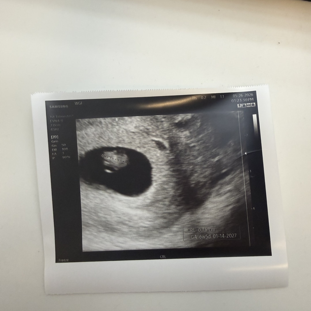 Photo shared by Bailey for their Babylist baby registry.
