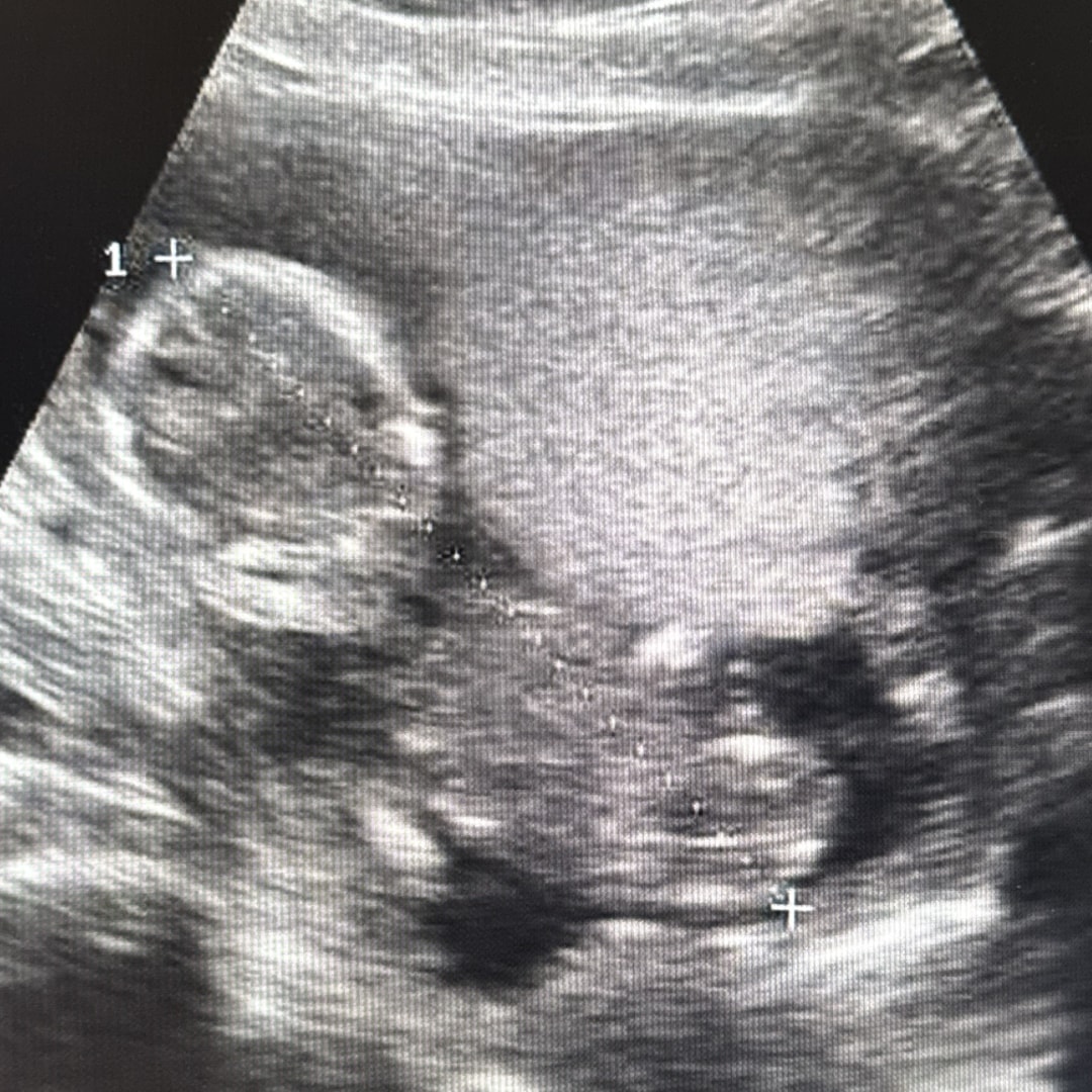 Photo shared by Lesly for their Babylist baby registry.