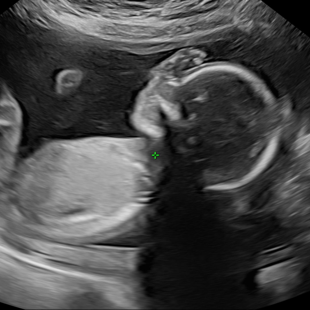Photo shared by Felicia for their Babylist baby registry.