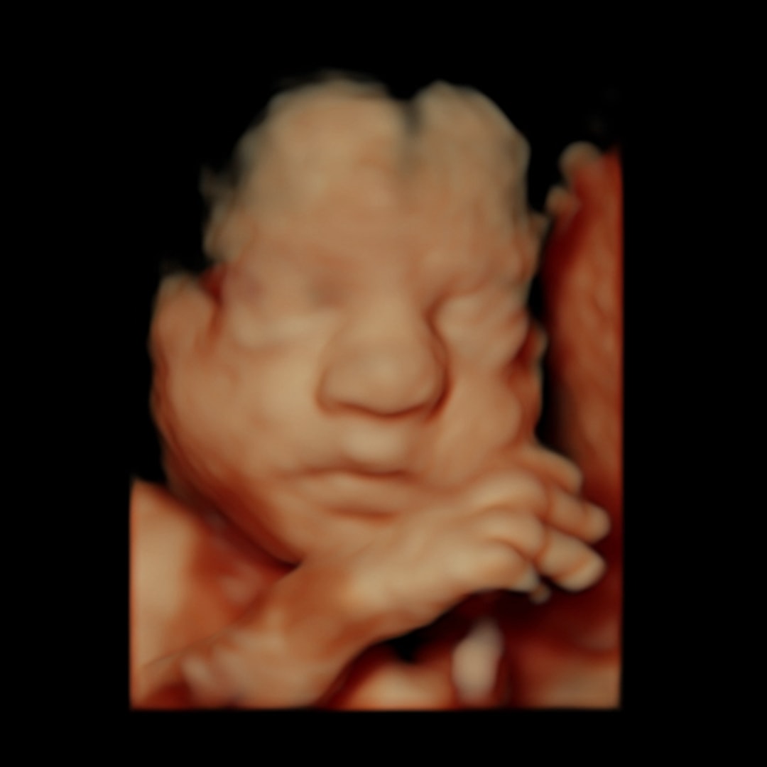 Photo shared by Callie for their Babylist baby registry.