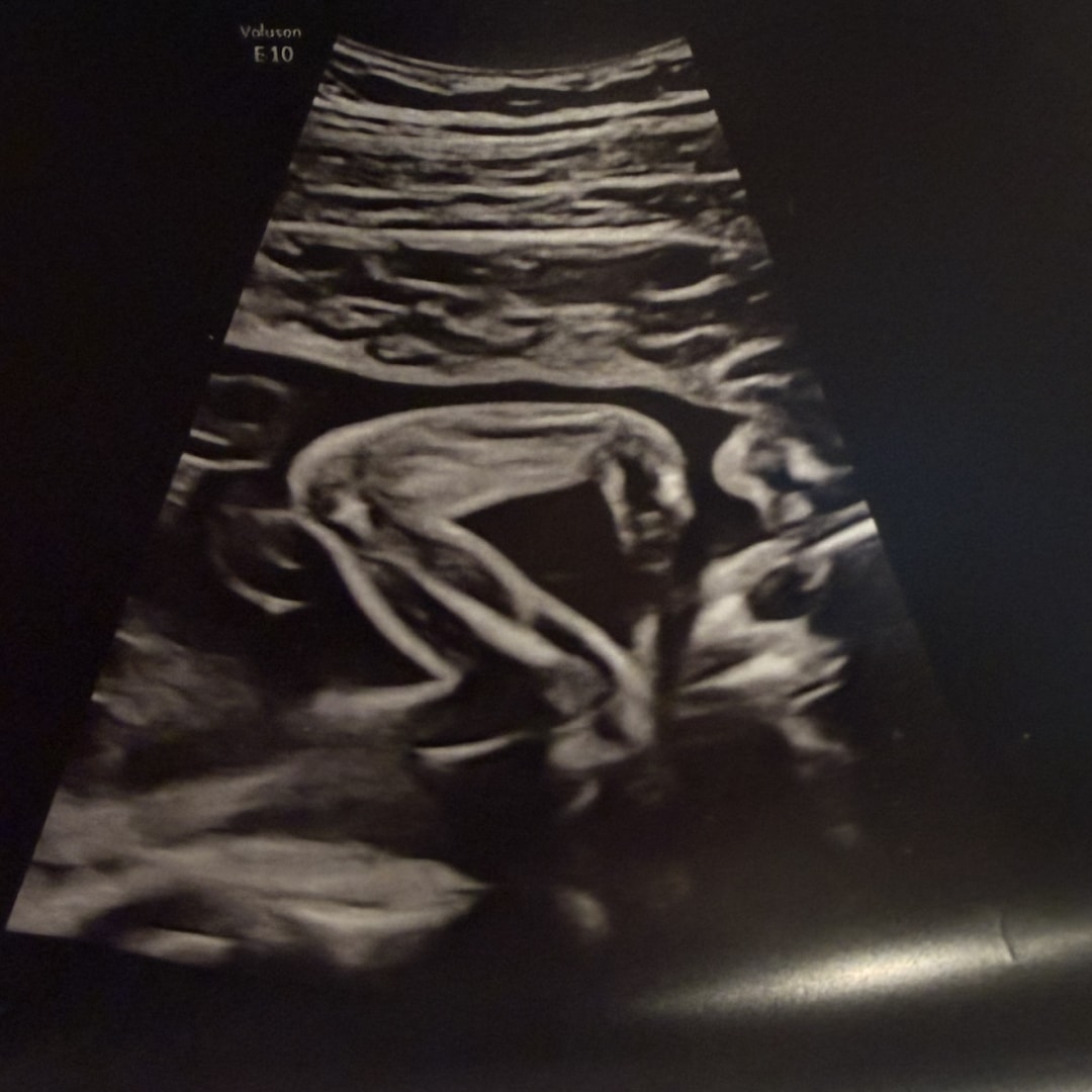 Photo shared by Skyelar for their Babylist baby registry.