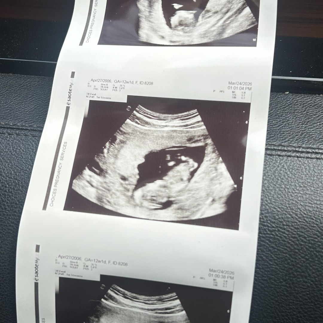 Photo shared by Brooklyn for their Babylist baby registry.