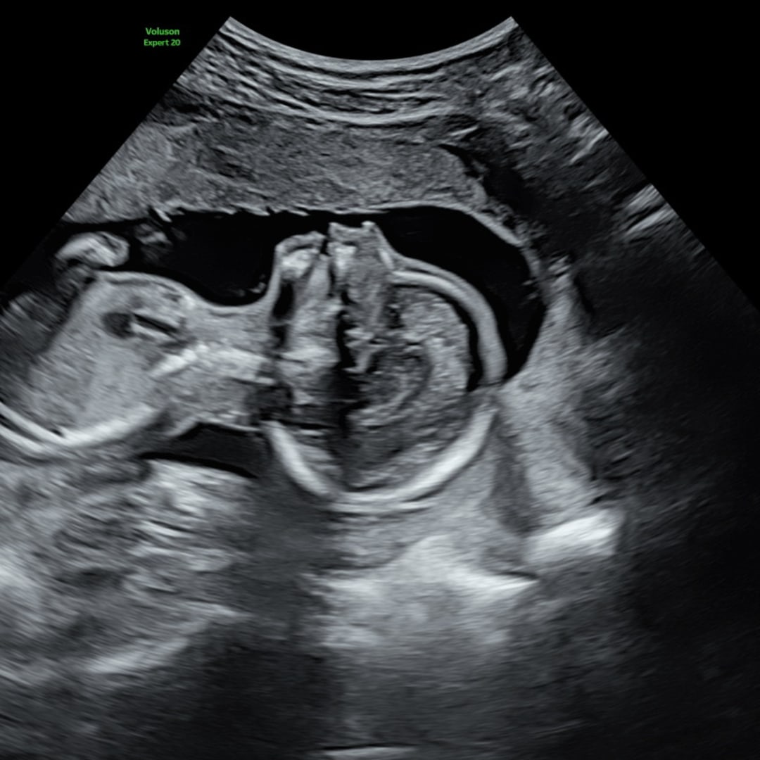 Photo shared by Hillary for their Babylist baby registry.