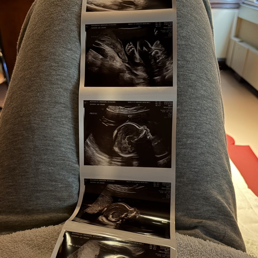 Photo shared by Madison for their Babylist baby registry.