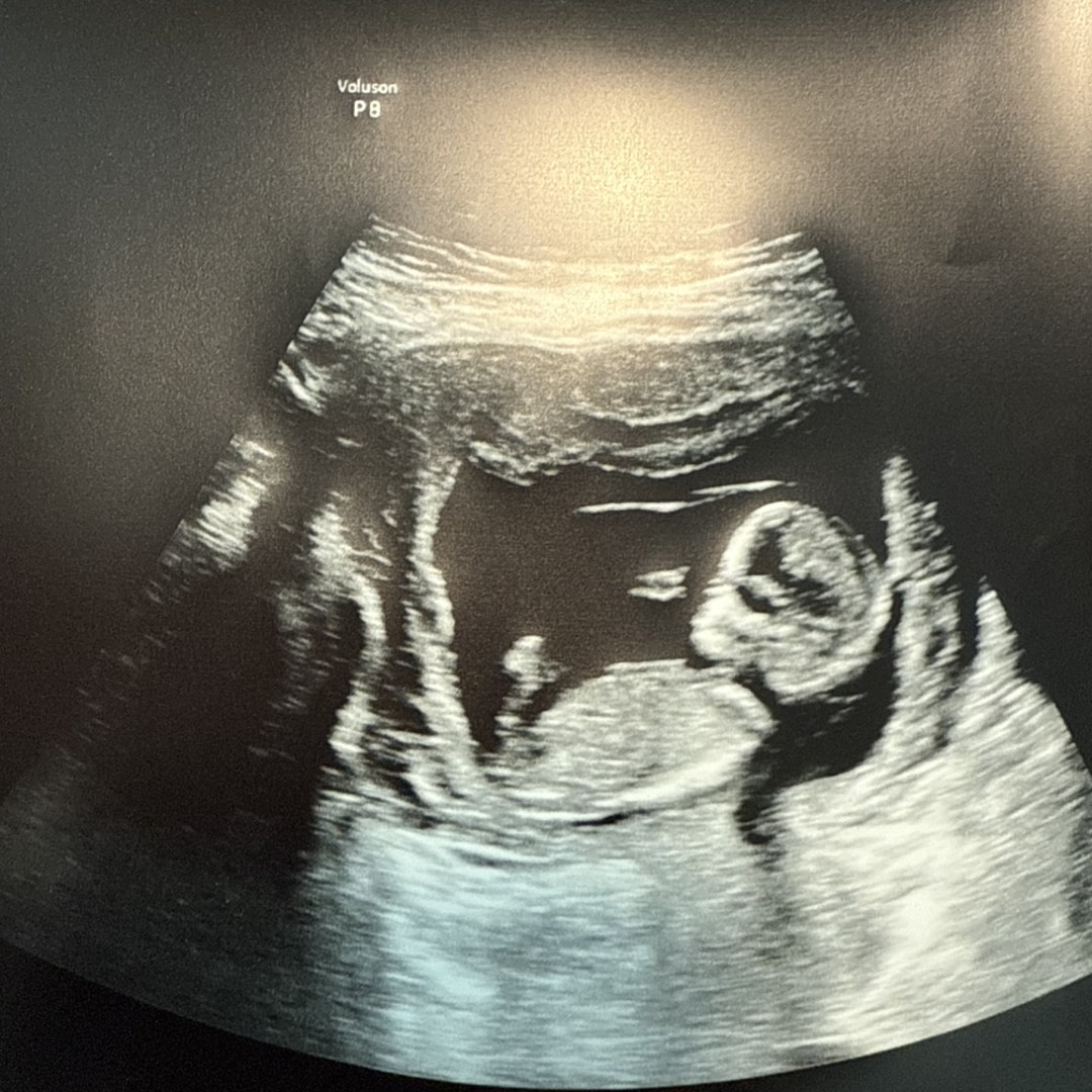 Photo shared by Sierra for their Babylist baby registry.