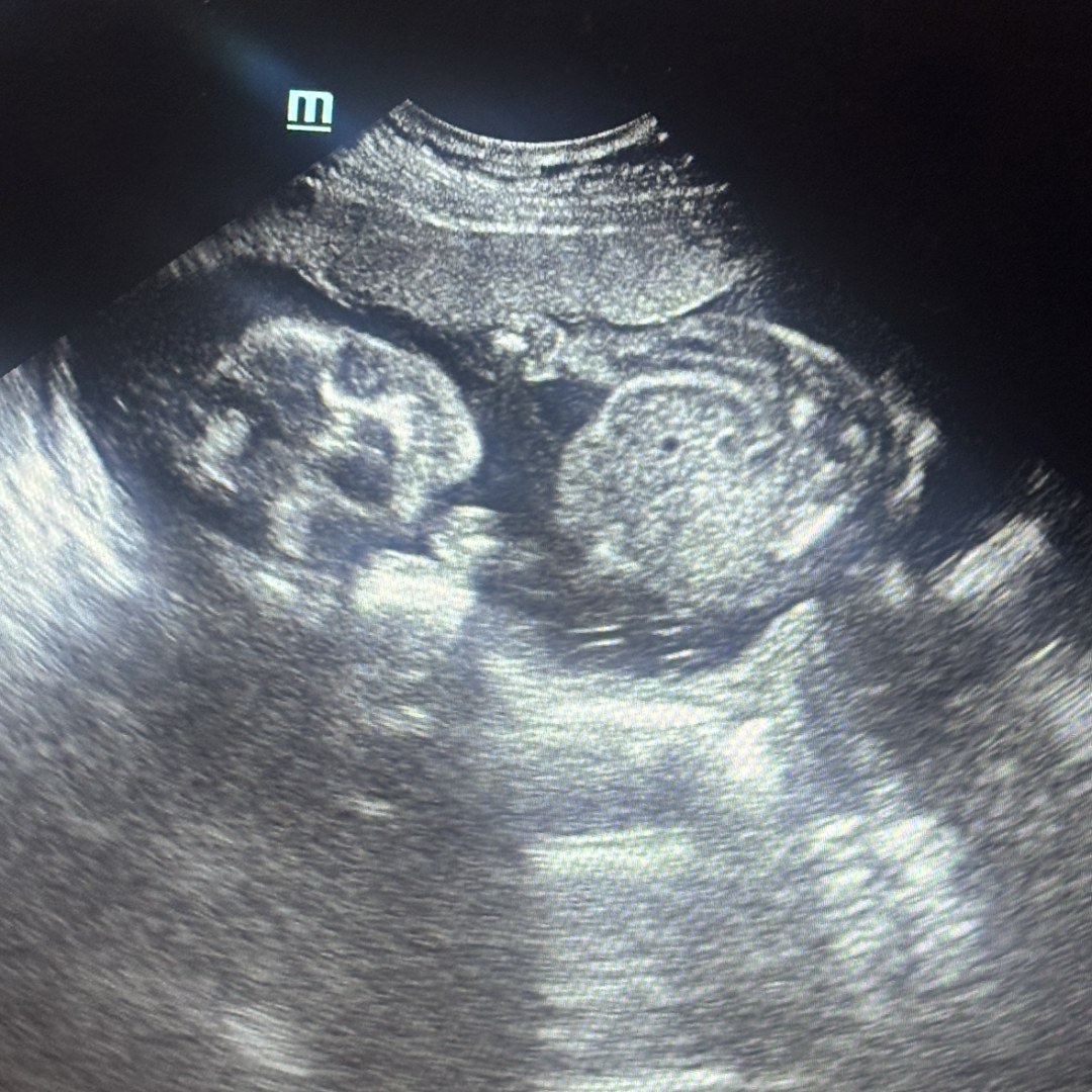 Photo shared by Gianna for their Babylist baby registry.