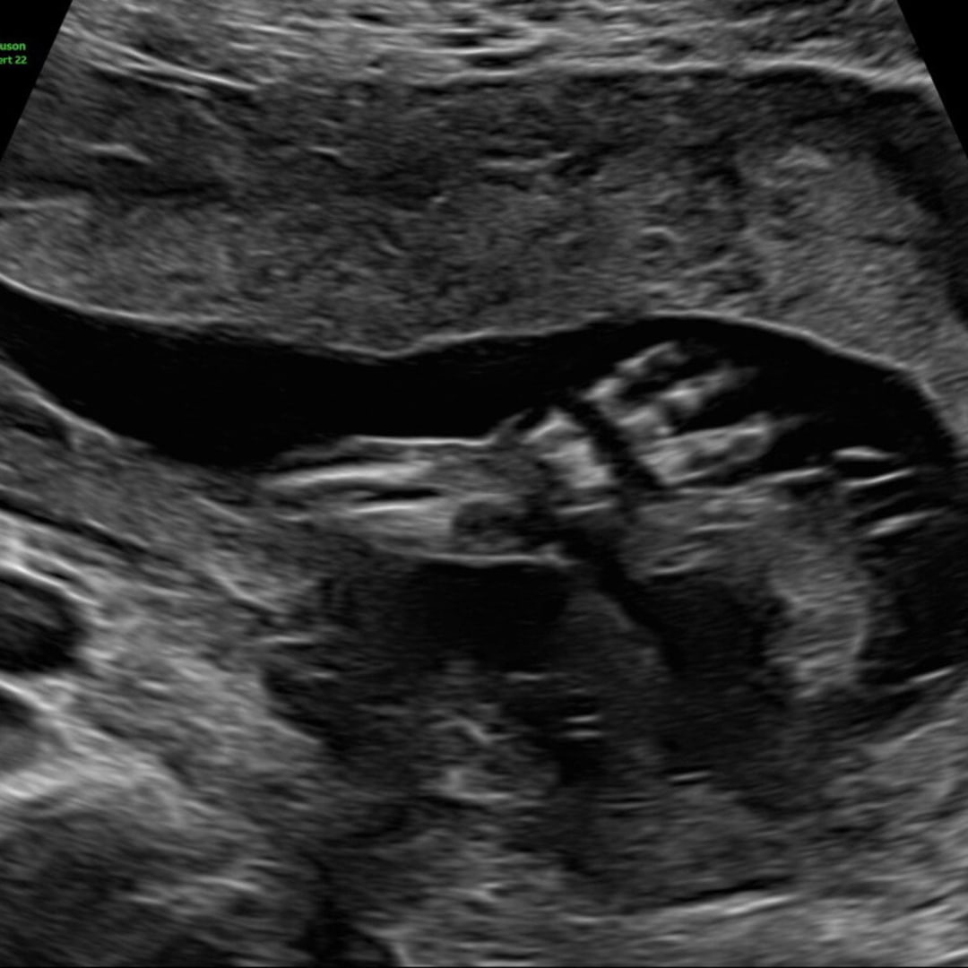 Photo shared by Beka for their Babylist baby registry.