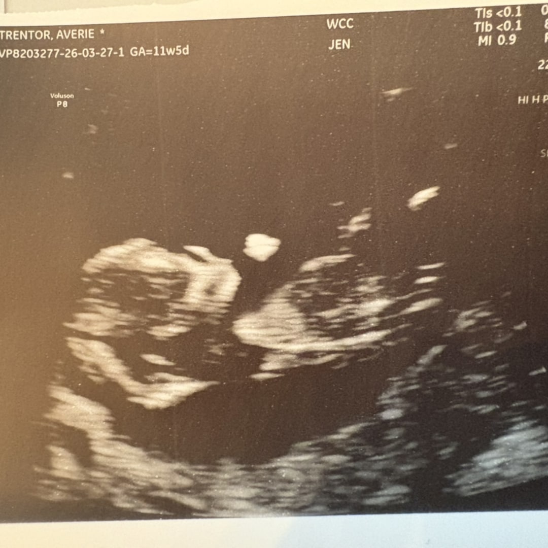 Photo shared by Averie for their Babylist baby registry.