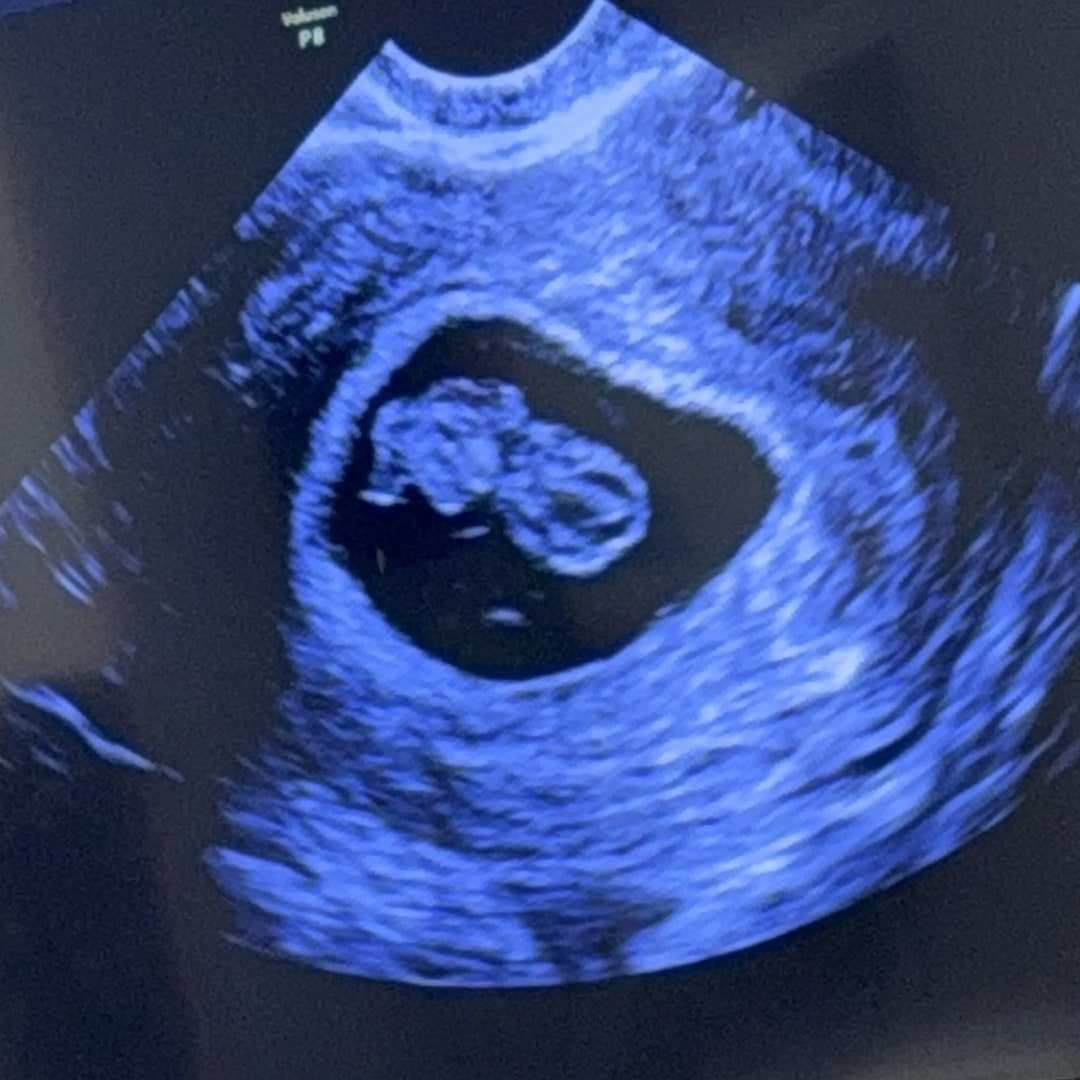 Photo shared by Irene Heder for their Babylist baby registry.