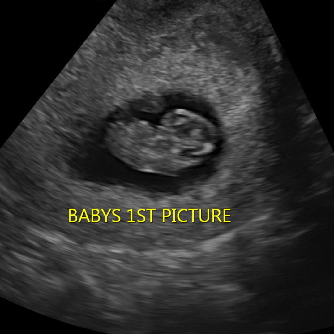 Photo shared by Mary for their Babylist baby registry.