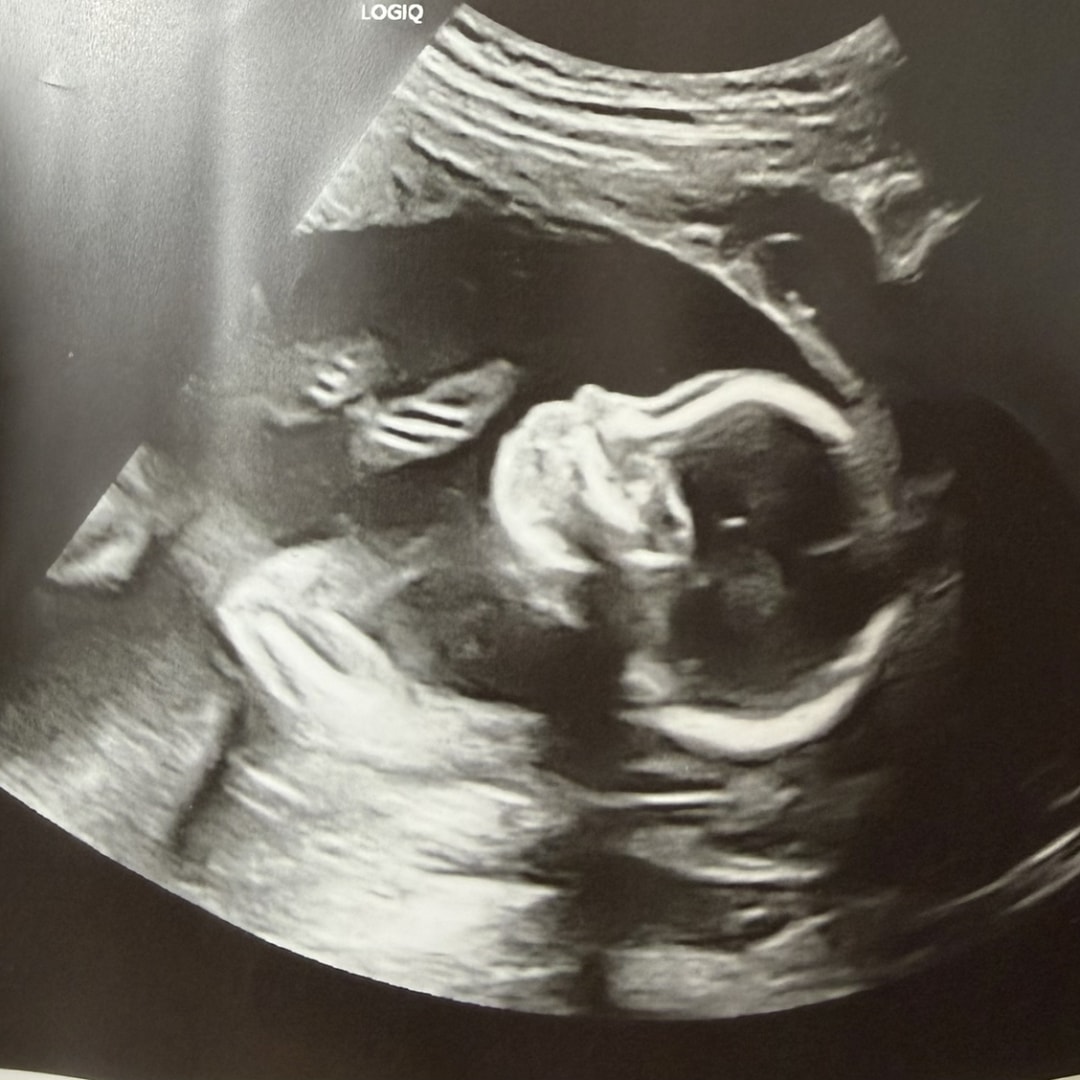 Photo shared by Zuarmy Marina for their Babylist baby registry.