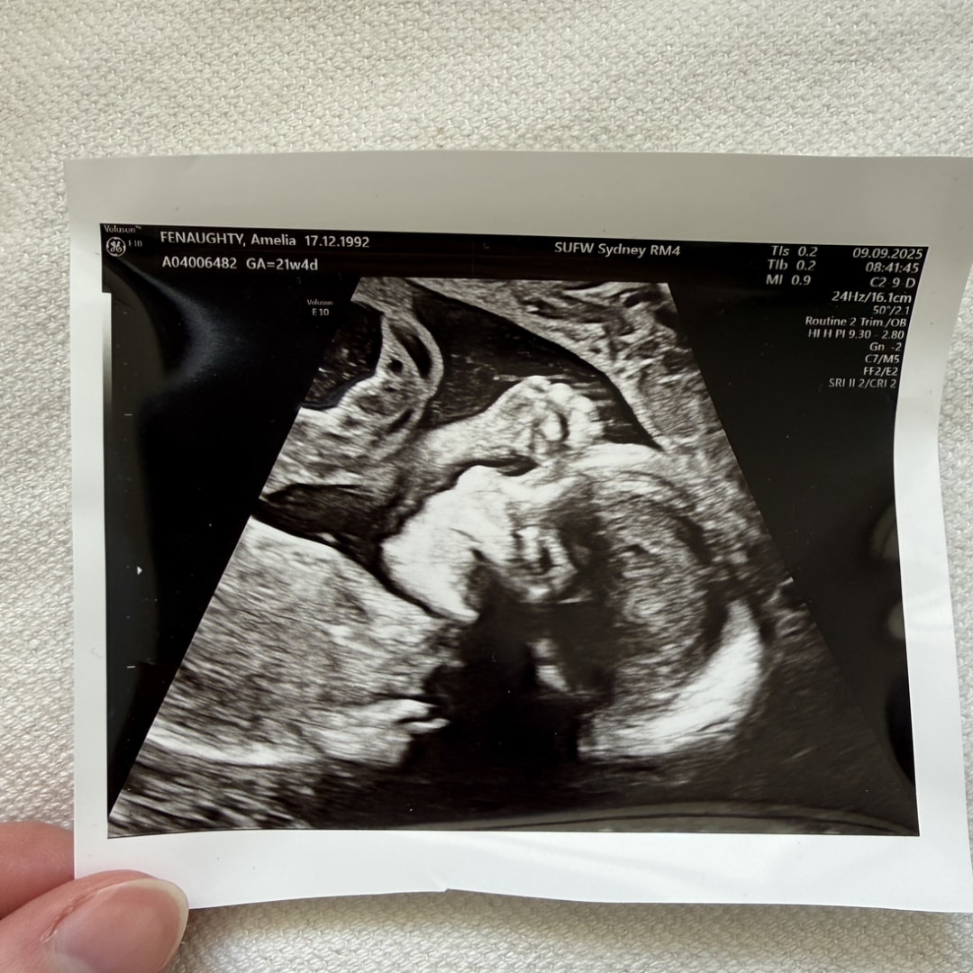 Photo shared by Amelia for their Babylist baby registry.