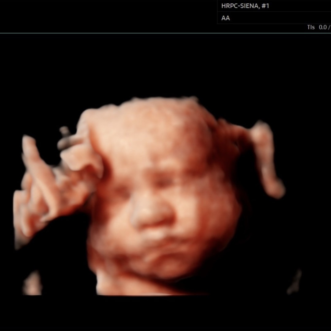 Photo shared by Marie for their Babylist baby registry.