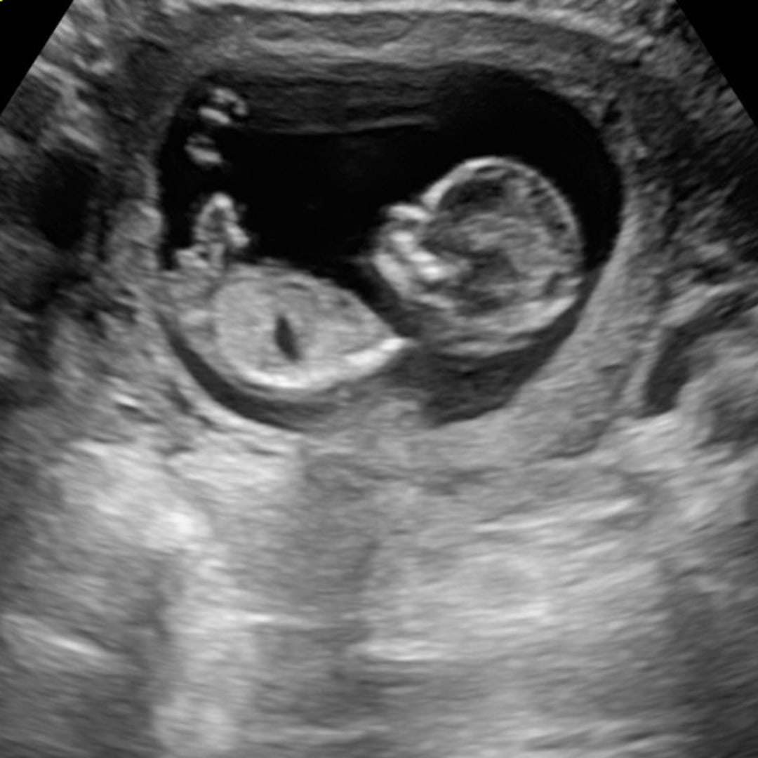 Photo shared by Paulina for their Babylist baby registry.