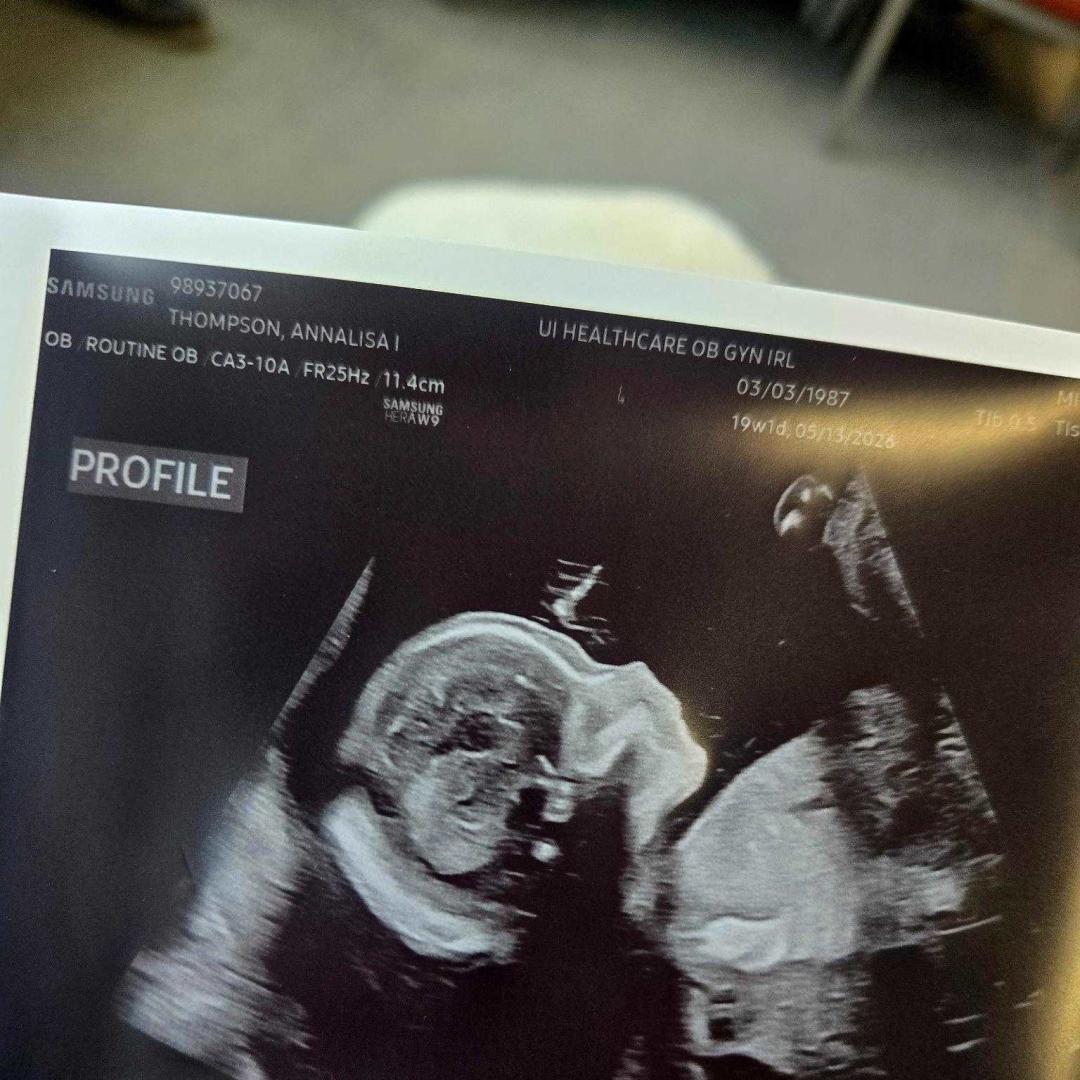 Photo shared by Anni for their Babylist baby registry.