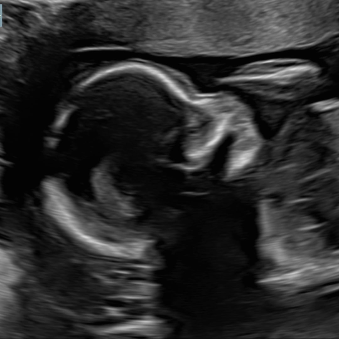 Photo shared by Ashley for their Babylist baby registry.