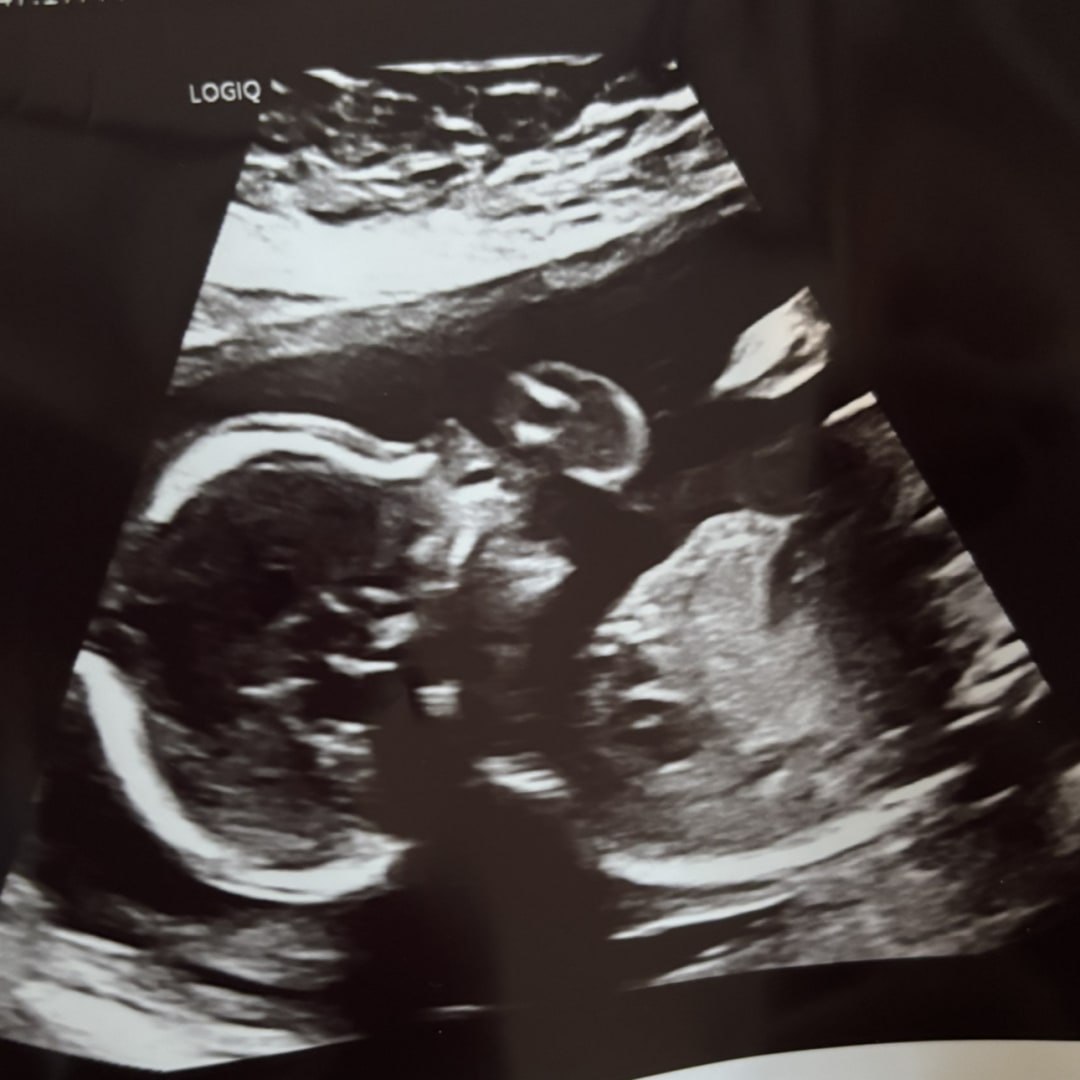 Photo shared by Jessica for their Babylist baby registry.