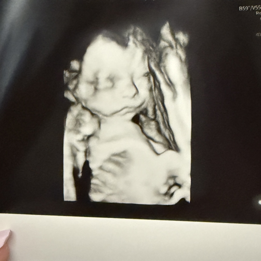 Photo shared by Camryn for their Babylist baby registry.