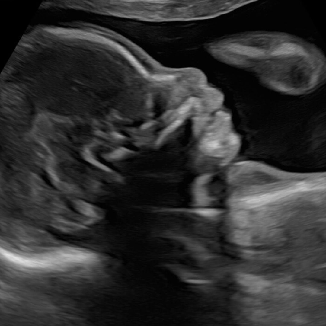 Photo shared by Sophie for their Babylist baby registry.