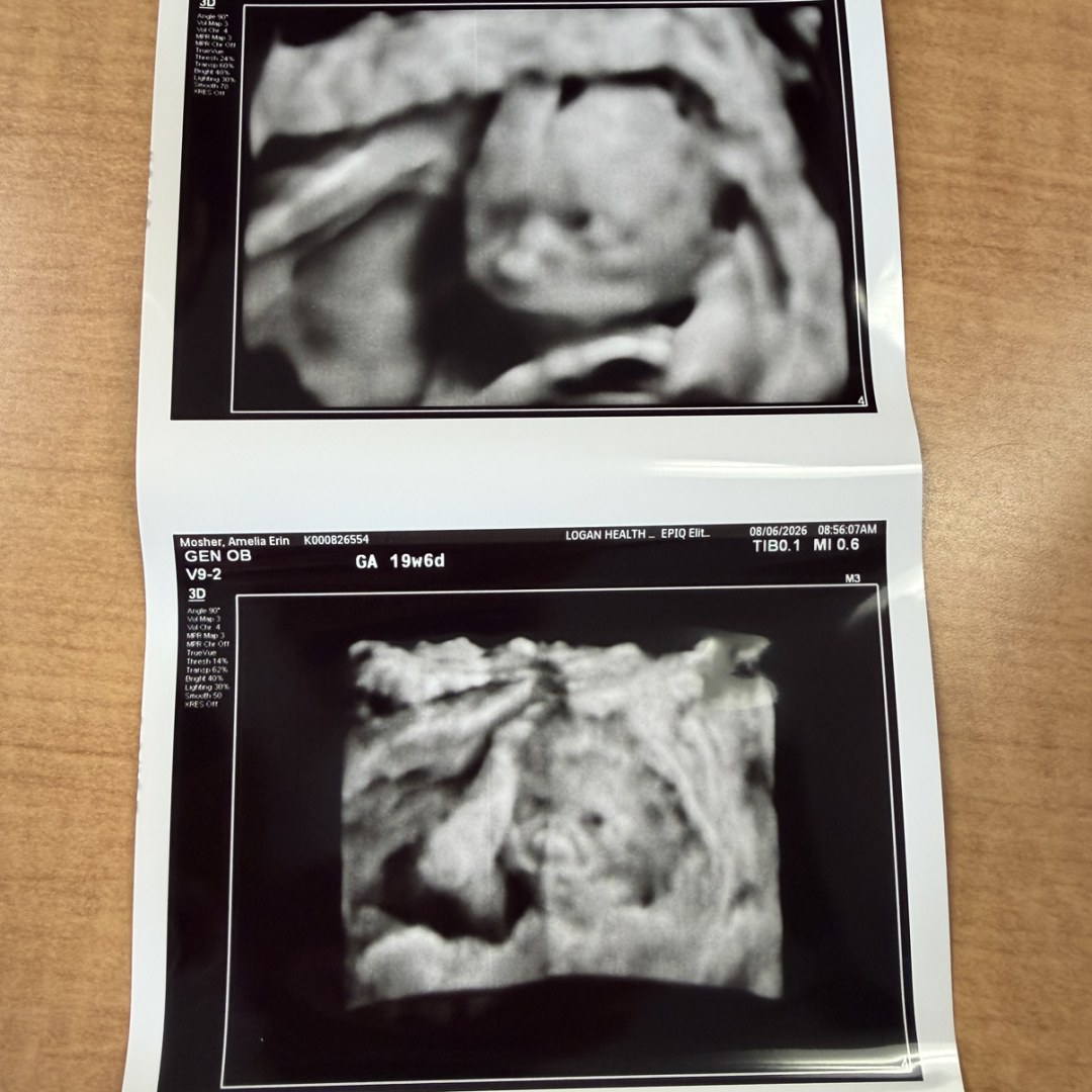 Photo shared by Amelia for their Babylist baby registry.