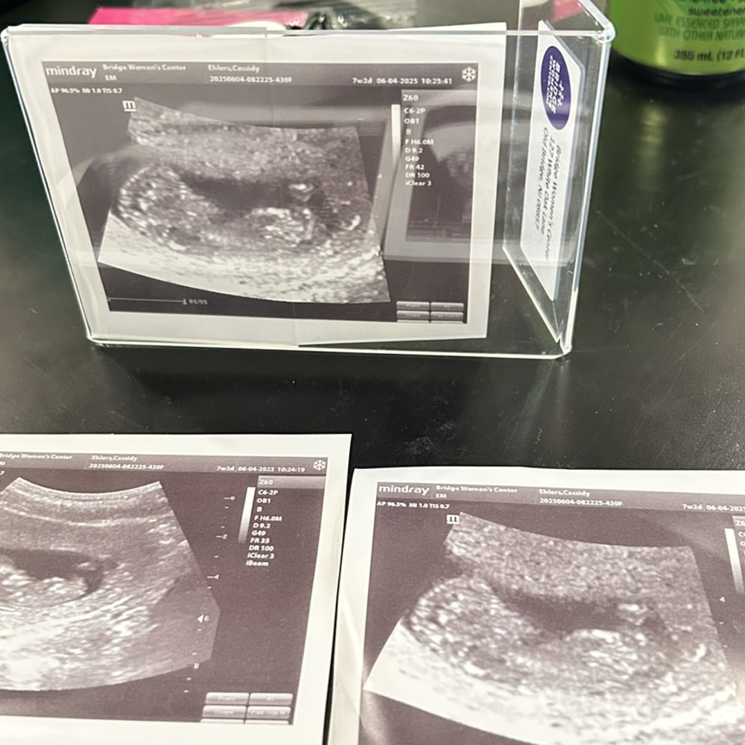 Photo shared by Cassidy for their Babylist baby registry.