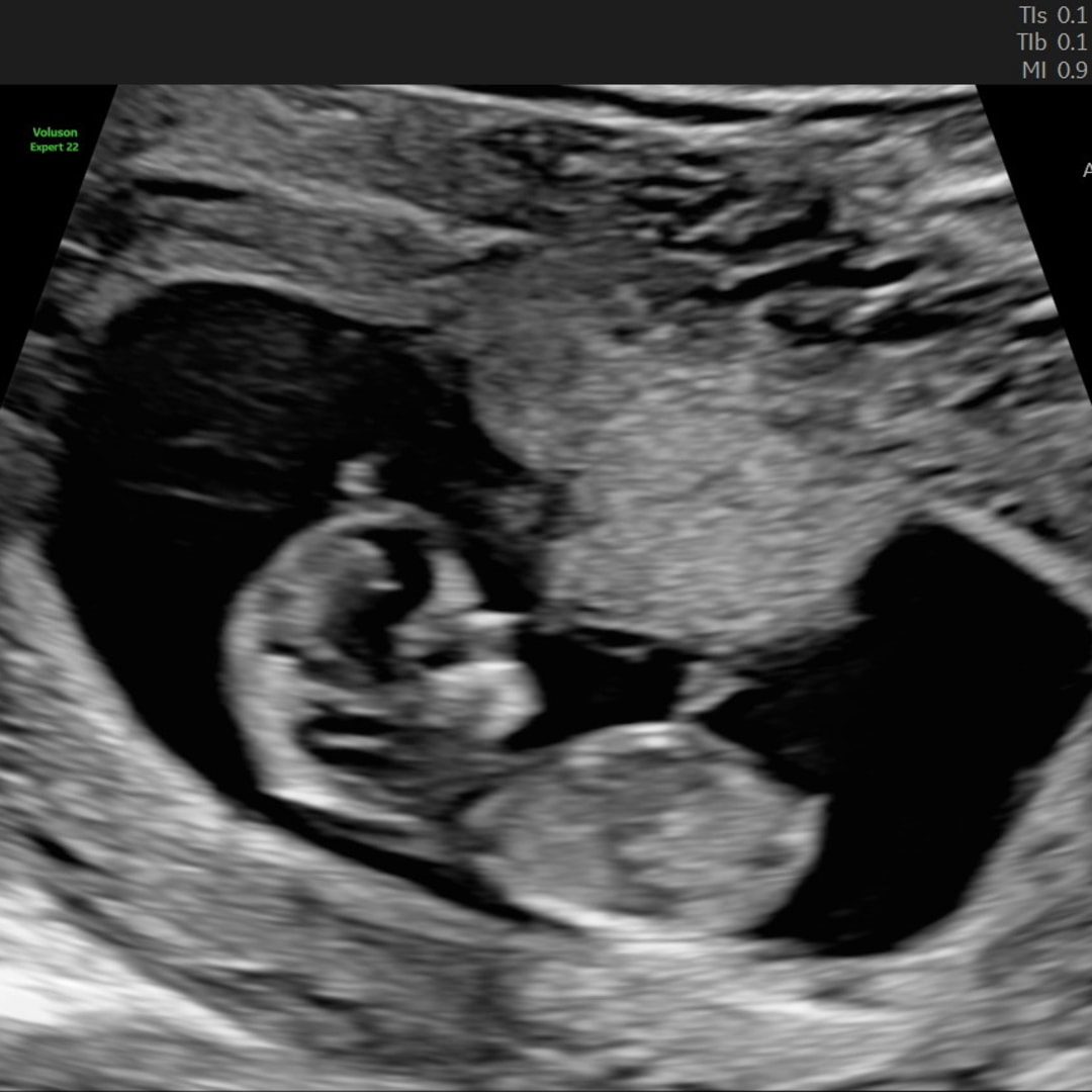 Photo shared by Ericka for their Babylist baby registry.