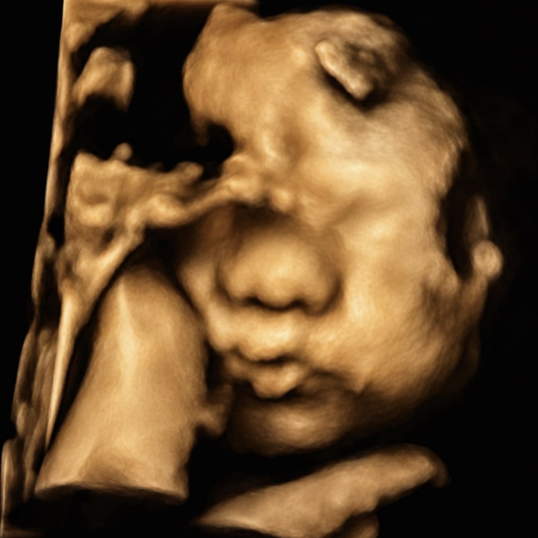 Photo shared by Sophia for their Babylist baby registry.