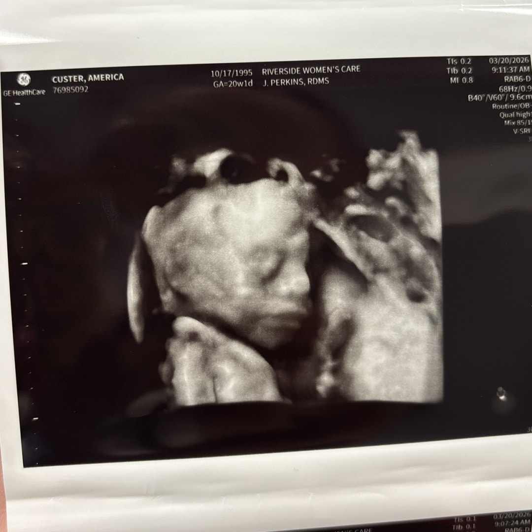 Photo shared by America for their Babylist baby registry.