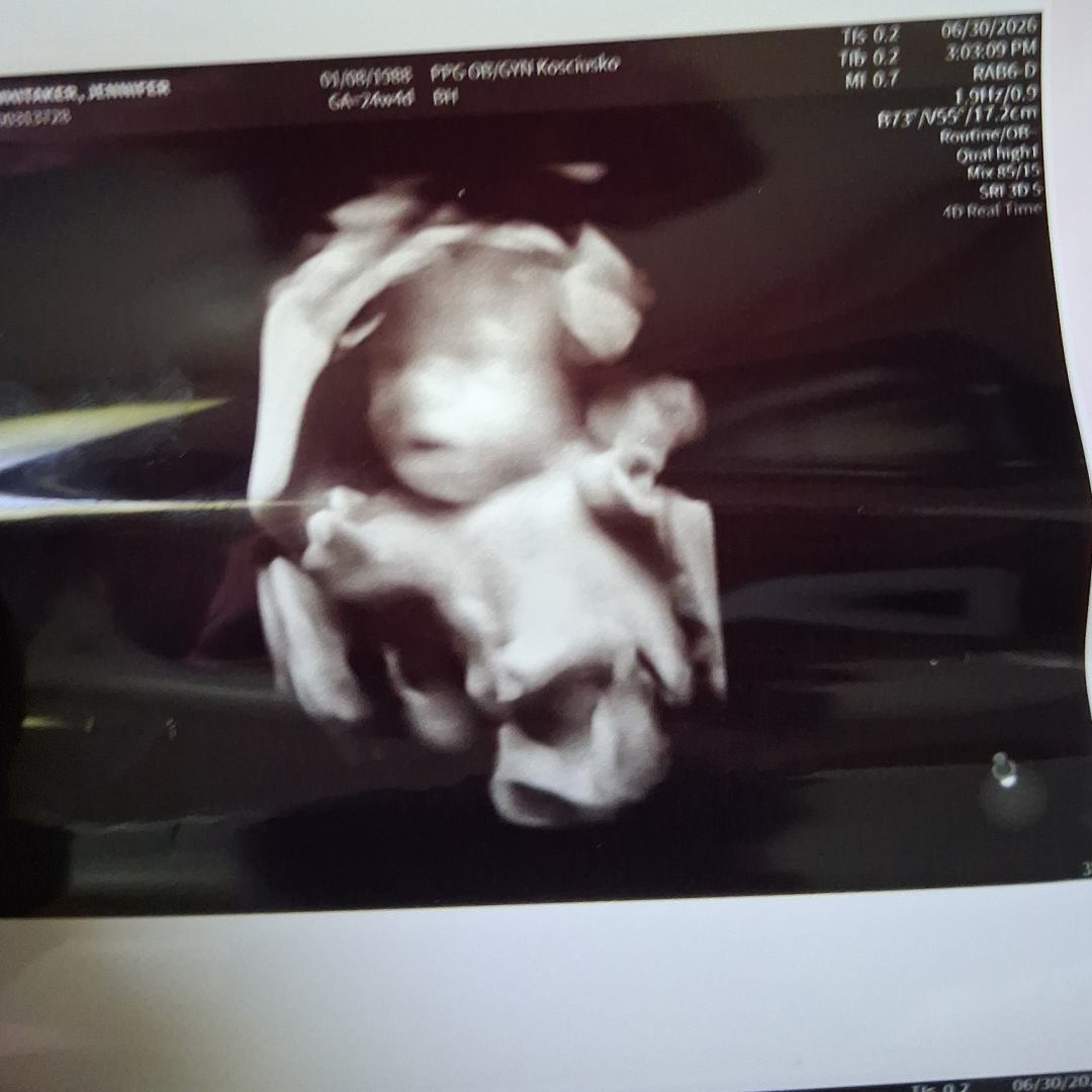 Photo shared by Jennifer for their Babylist baby registry.