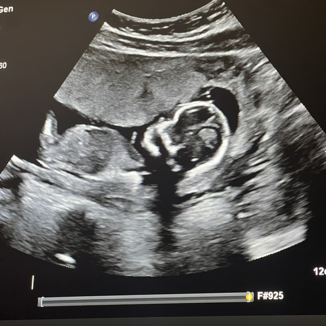 Photo shared by Jaya for their Babylist baby registry.