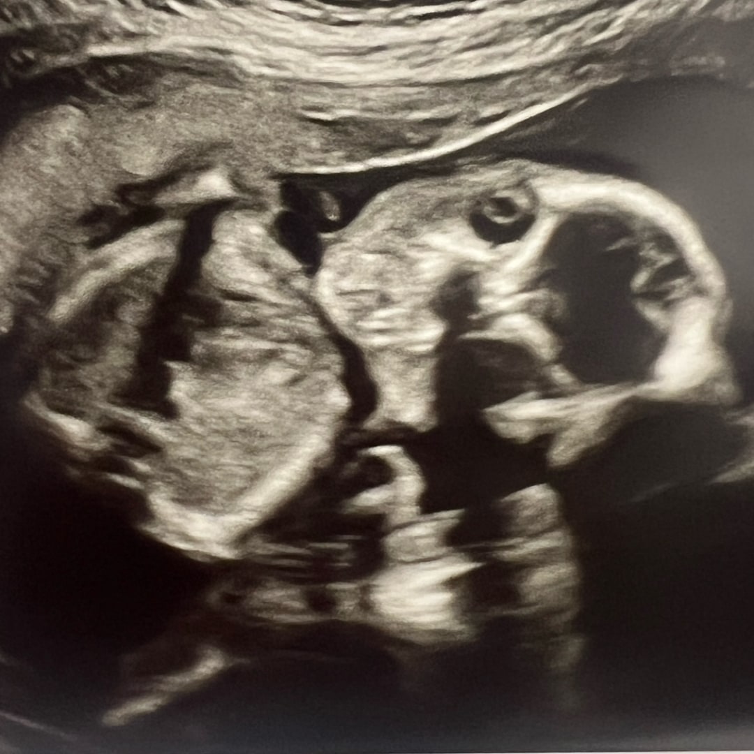 Photo shared by Hailey-Millicent for their Babylist baby registry.