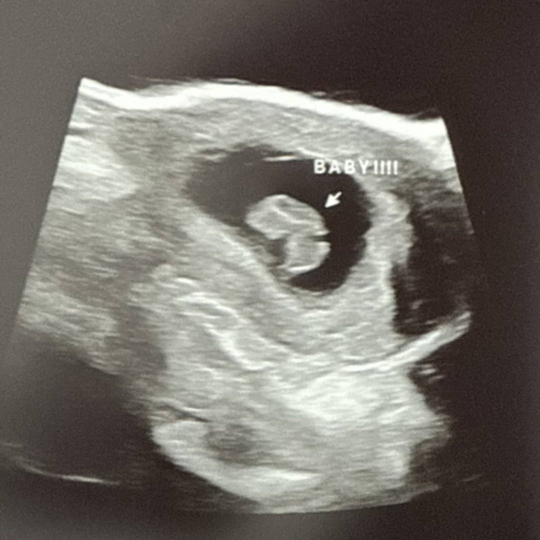 Photo shared by Megan for their Babylist baby registry.