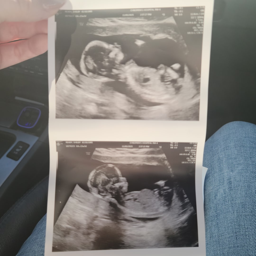 Photo shared by Shelby for their Babylist baby registry.