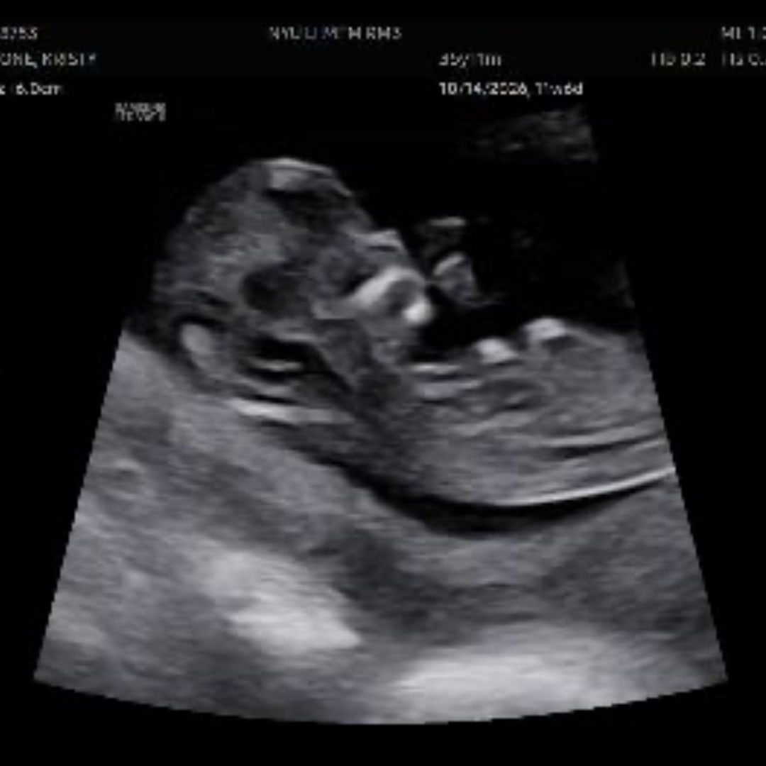 Photo shared by Kristy for their Babylist baby registry.