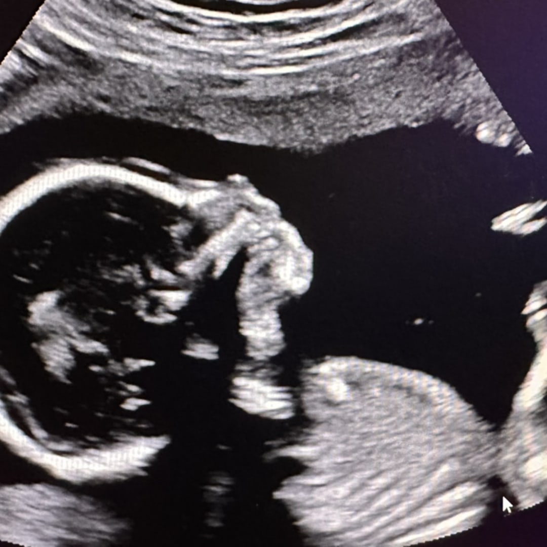 Photo shared by Christine for their Babylist baby registry.