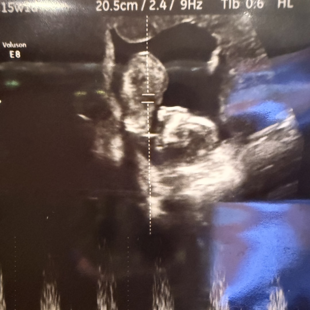 Photo shared by Nevaeh for their Babylist baby registry.