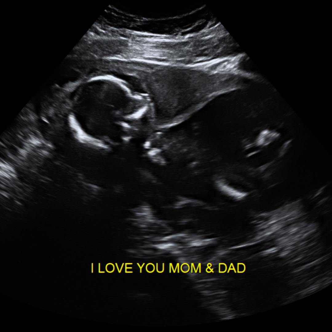 Photo shared by Sasha for their Babylist baby registry.